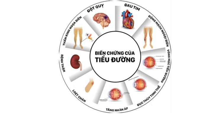 Các biến chứng của bệnh đái tháo đường