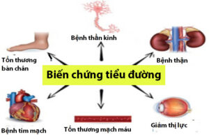 biến chứng mãn tính của bệnh tiểu đường